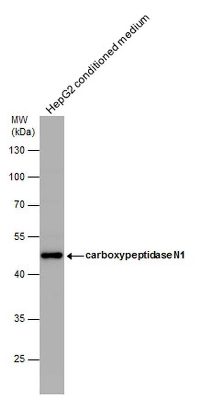 CPN1 Antibody in Western Blot (WB)