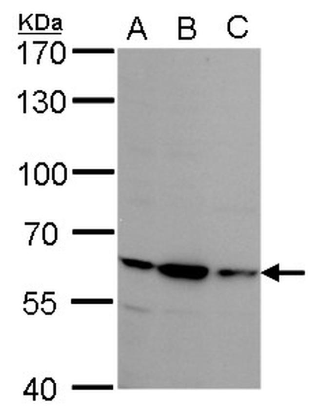 STS Antibody in Western Blot (WB)