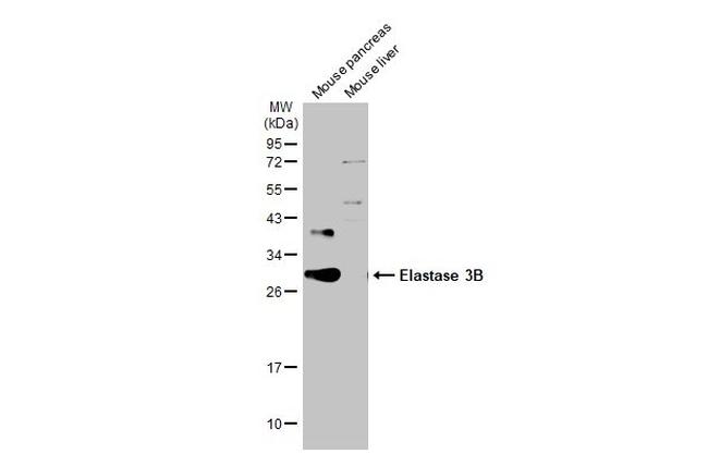 CELA3B Antibody in Western Blot (WB)