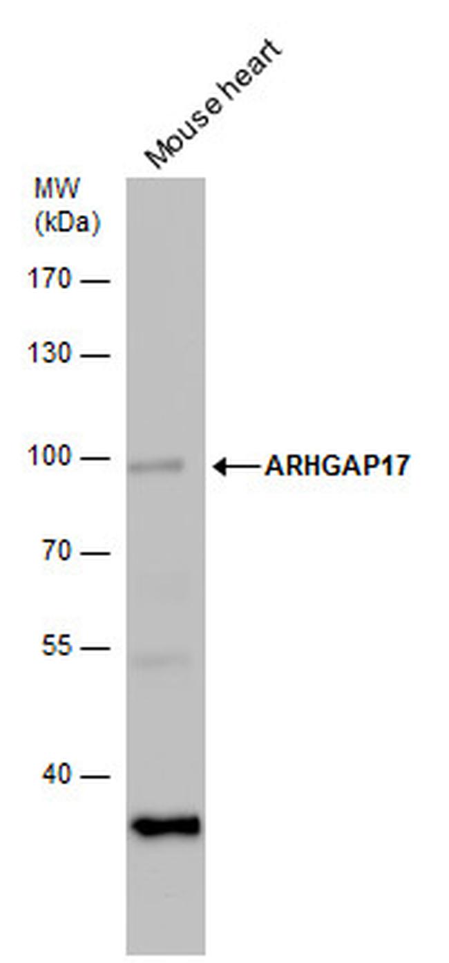 ARHGAP17 Antibody in Western Blot (WB)