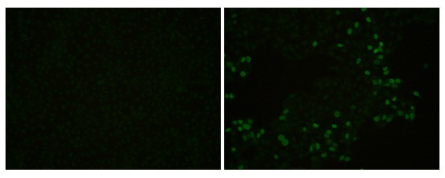 PRRS Virus Nucleocapsid Protein Antibody in Immunocytochemistry (ICC/IF)