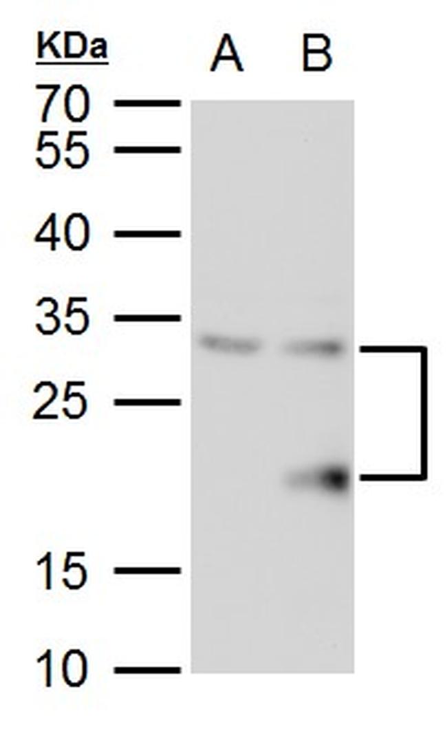 SMUG1 Antibody in Western Blot (WB)