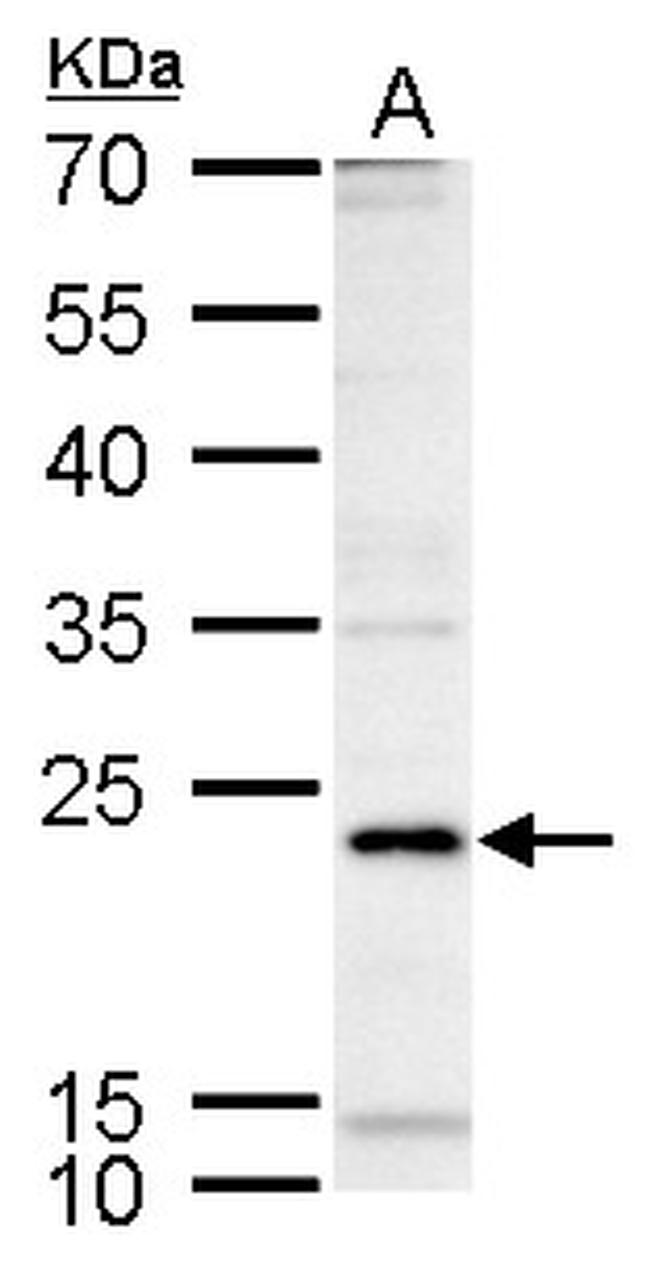 ICOS Antibody in Western Blot (WB)