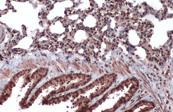 CrkRS Antibody in Immunohistochemistry (Paraffin) (IHC (P))