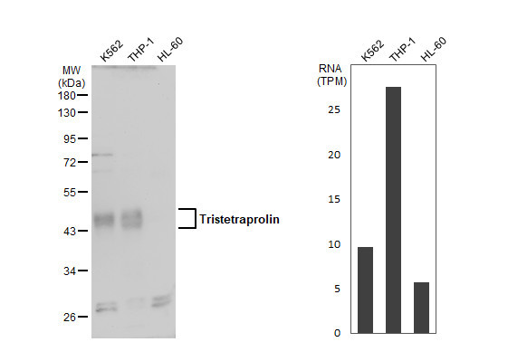 ZFP36 Antibody in Western Blot (WB)