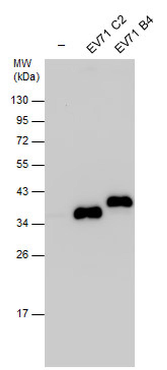 Enterovirus 71 VP1 Antibody in Western Blot (WB)