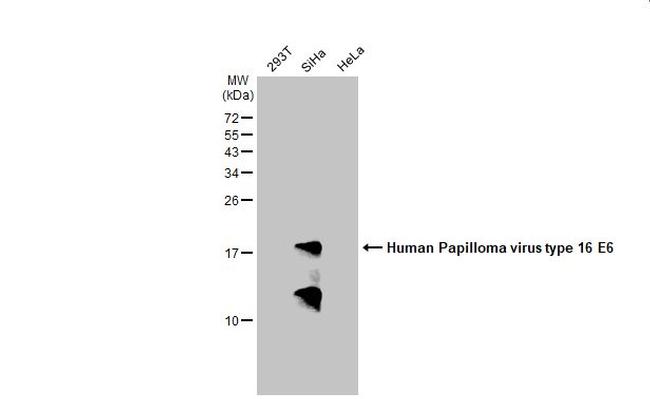 HPV Type 16 E6 Antibody in Western Blot (WB)