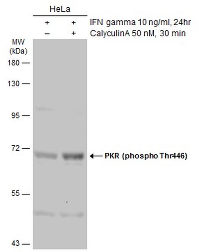 Phospho-PKR (Thr446) Antibody in Western Blot (WB)