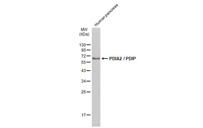 PDIA2 Antibody in Western Blot (WB)