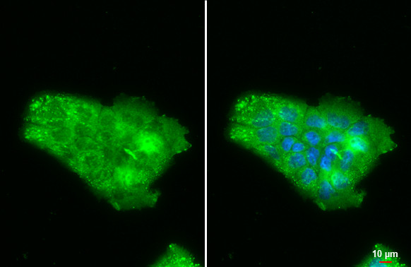 NGAL Antibody in Immunocytochemistry (ICC/IF)