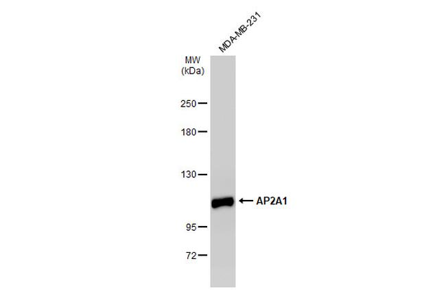 AP2A1 Antibody in Western Blot (WB)