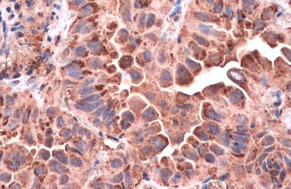 CD63 Antibody in Immunohistochemistry (Paraffin) (IHC (P))
