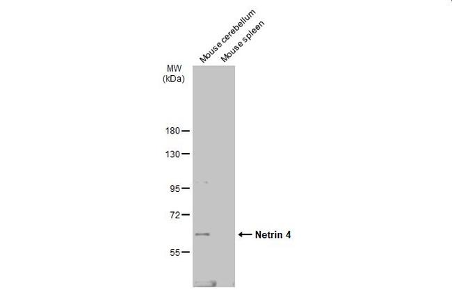NTN4 Antibody in Western Blot (WB)