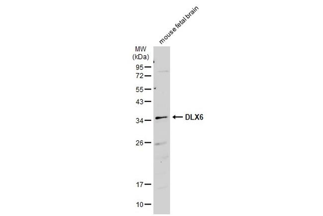 DLX6 Antibody in Western Blot (WB)