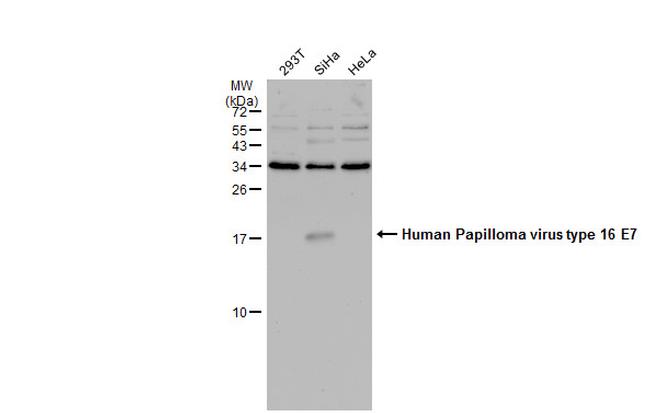 HPV Type 16 E7 Antibody in Western Blot (WB)