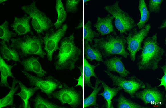 HPV Type 18 E7 Antibody in Immunocytochemistry (ICC/IF)