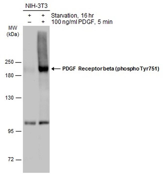 Phospho-PDGF Receptor beta (Tyr751) Antibody in Western Blot (WB)