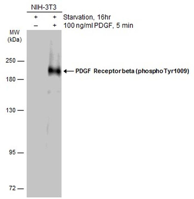 Phospho-PDGF Receptor beta (Tyr1009) Antibody in Western Blot (WB)