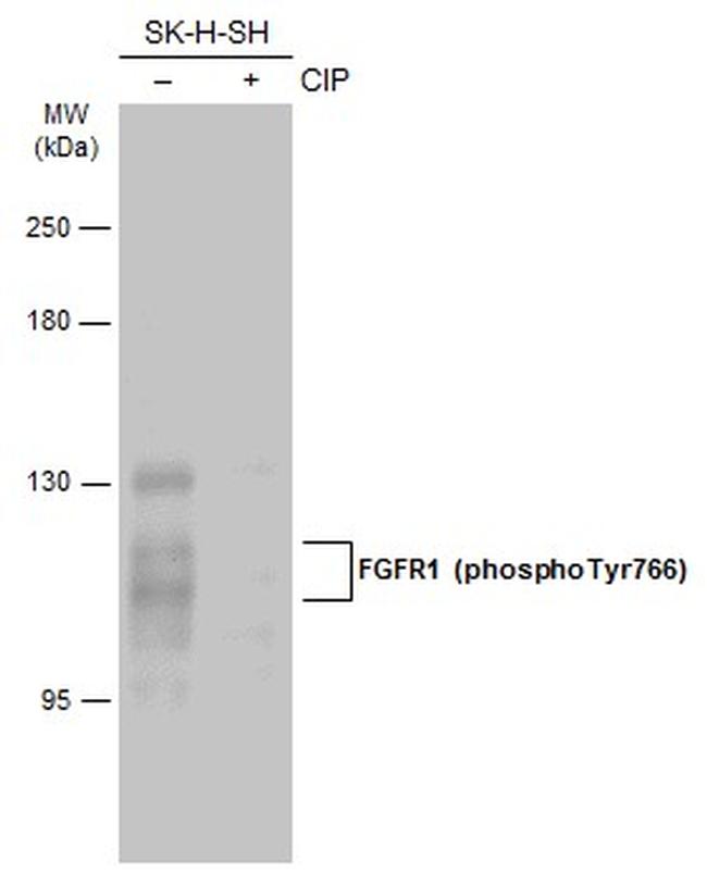 Phospho-FGFR1 (Tyr766) Antibody in Western Blot (WB)
