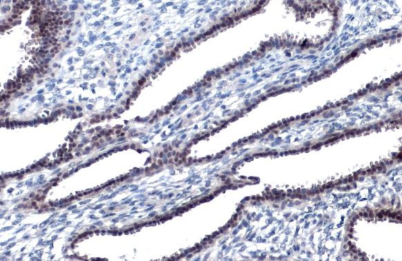 Phospho-JNK1 (Thr183, Tyr185) Antibody in Immunohistochemistry (Paraffin) (IHC (P))