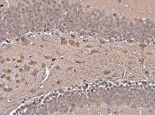 HuD Antibody in Immunohistochemistry (Paraffin) (IHC (P))