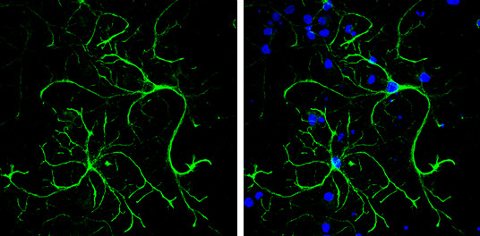 SYNM Antibody in Immunocytochemistry (ICC/IF)