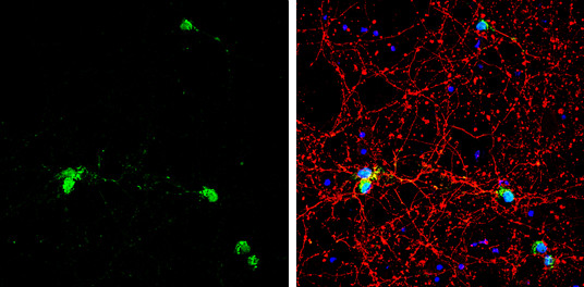 HuC Antibody in Immunocytochemistry (ICC/IF)