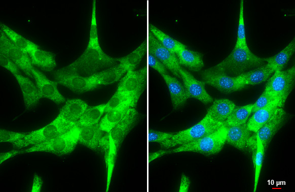 FMRP Antibody in Immunocytochemistry (ICC/IF)