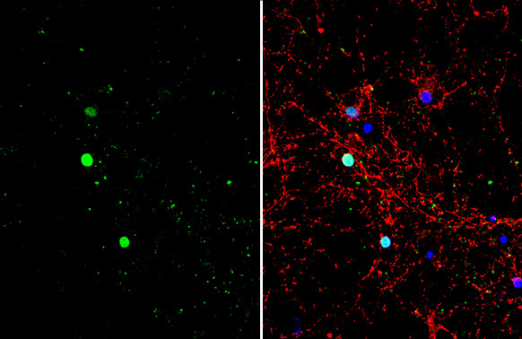 BCL11B Antibody in Immunocytochemistry (ICC/IF)