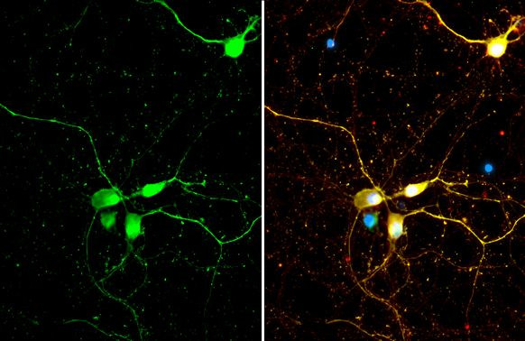 SMCR8 Antibody in Immunocytochemistry (ICC/IF)