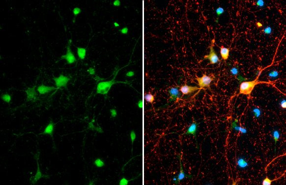 SMCR8 Antibody in Immunocytochemistry (ICC/IF)
