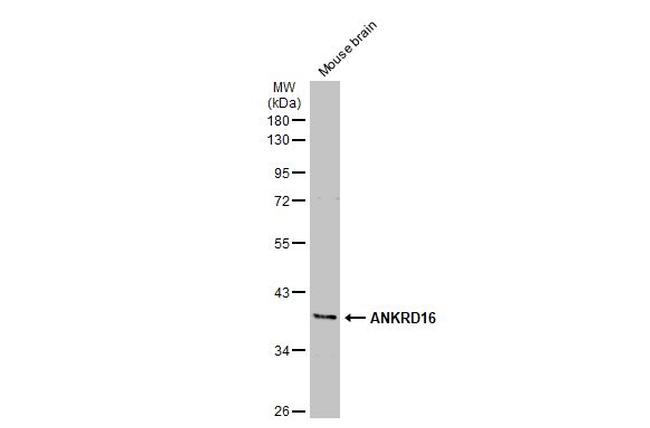 ANKRD16 Antibody in Western Blot (WB)
