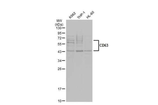 CD63 Antibody in Western Blot (WB)