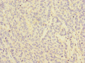 CD32c (FCGR2C) Antibody in Immunohistochemistry (Paraffin) (IHC (P))