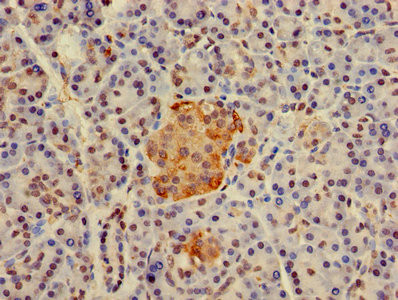 H2AFJ Antibody in Immunohistochemistry (Paraffin) (IHC (P))