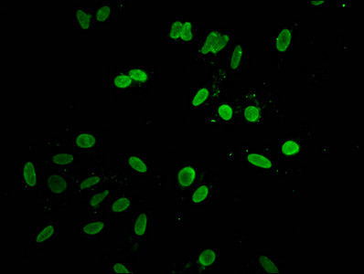 Histone H1.3 Antibody in Immunocytochemistry (ICC/IF)