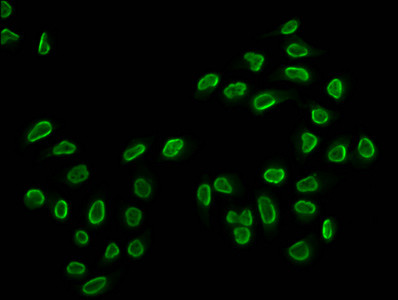 Butyryl-HIST1H2BC (Lys20) Antibody in Immunocytochemistry (ICC/IF)