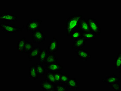 Crotonyl-HIST1H2BC (Lys20) Antibody in Immunocytochemistry (ICC/IF)