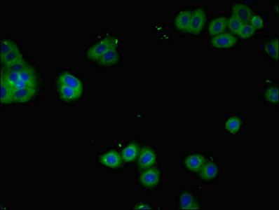 CD25 Antibody in Immunocytochemistry (ICC/IF)