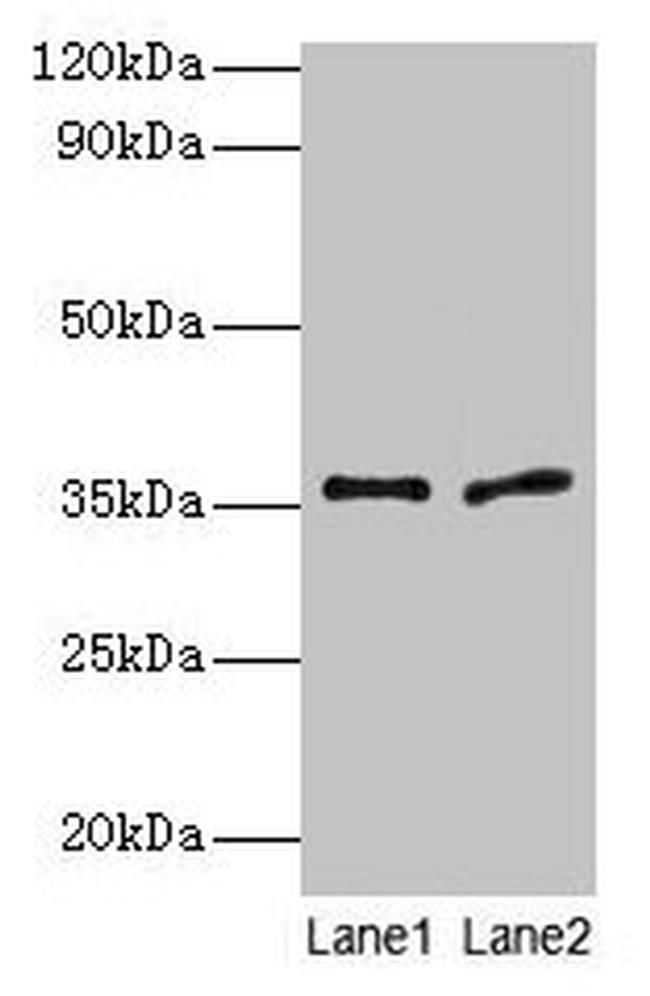 uPAR Antibody in Western Blot (WB)