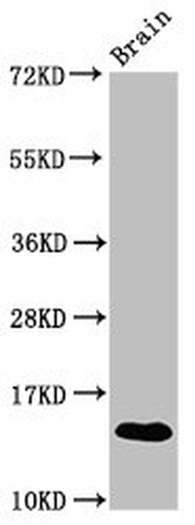S100A9 Antibody in Western Blot (WB)
