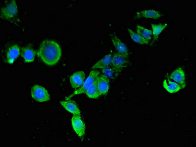 WNT5A Antibody in Immunocytochemistry (ICC/IF)