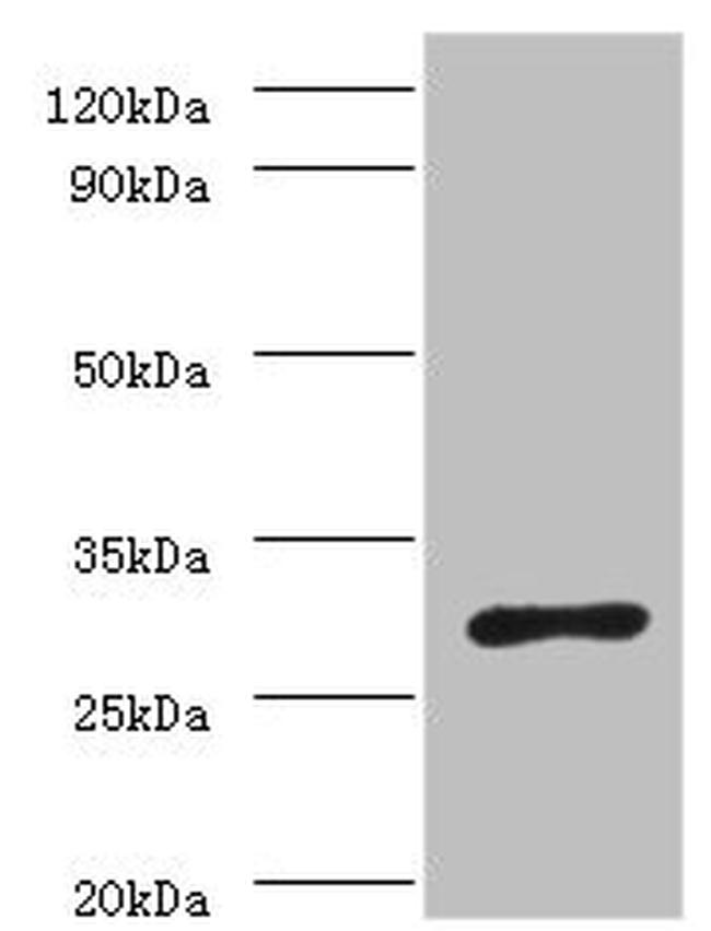 Helicobacter pylori ureA Antibody in Western Blot (WB)