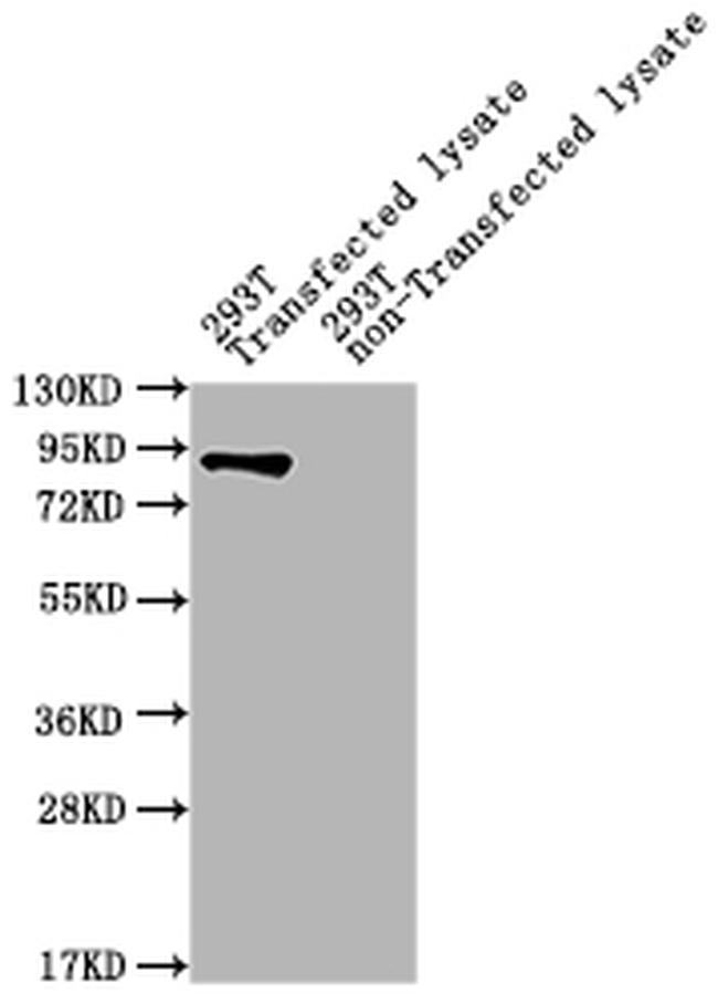 Helicobacter pylori ureB Antibody in Western Blot (WB)