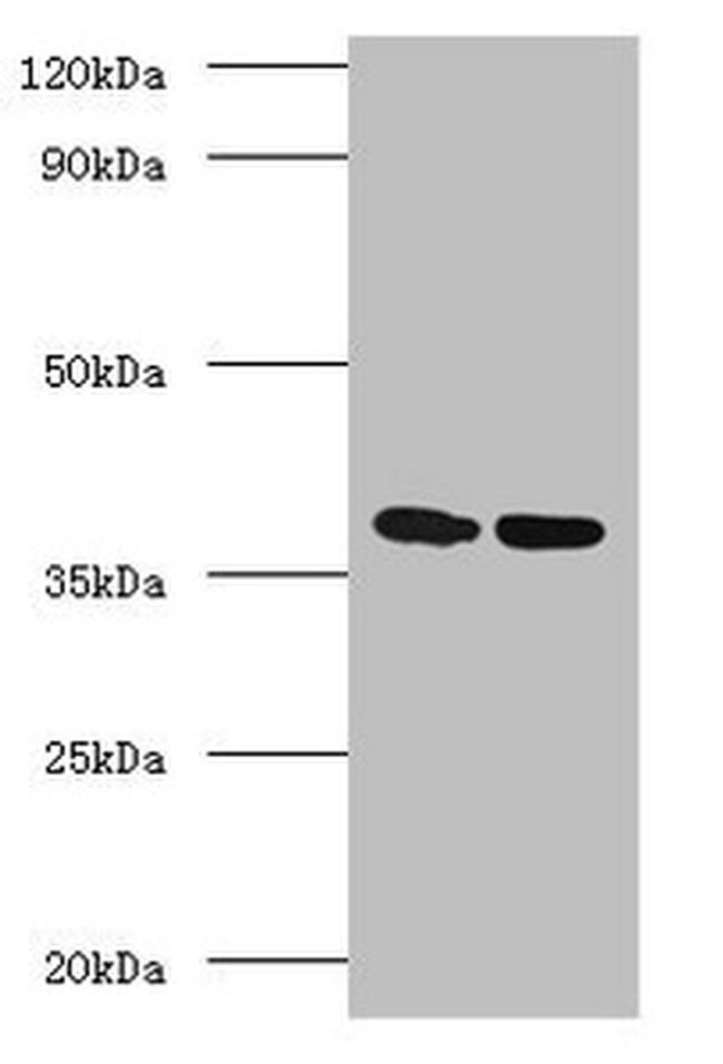 Mycobacterium tuberculosis Ag85A Antibody in Western Blot (WB)