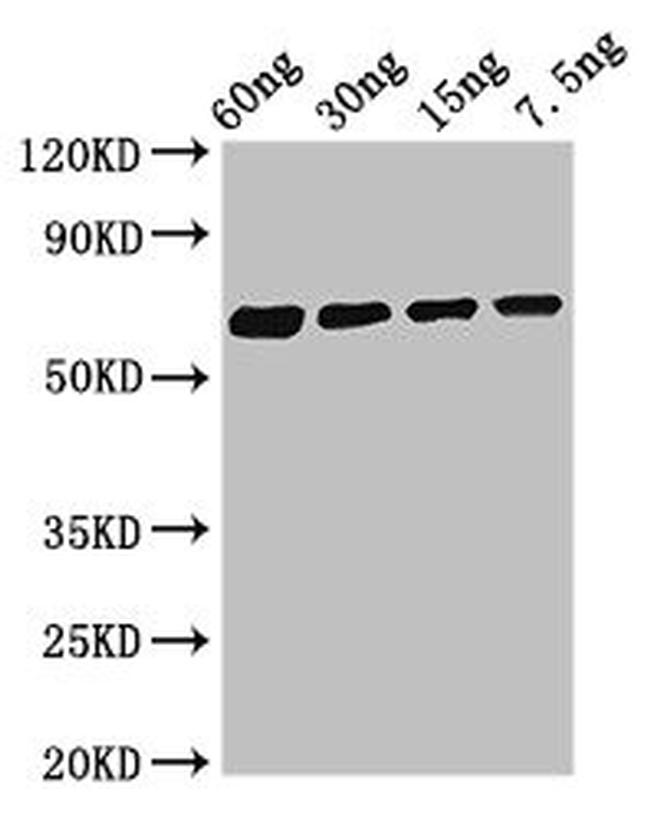 Blattella germanica Major allergen Bla g 1.0101 Antibody in Western Blot (WB)