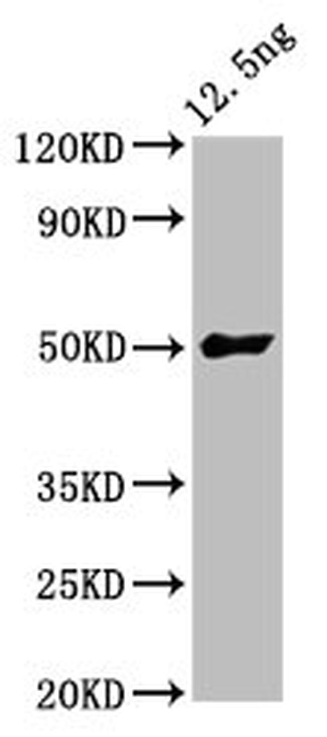 Soybean FTL3 Antibody in Western Blot (WB)