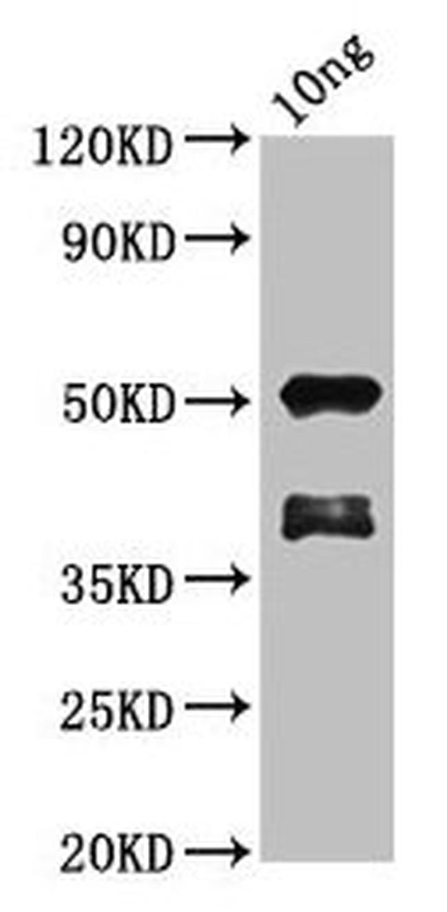 BRCA2 Antibody in Western Blot (WB)
