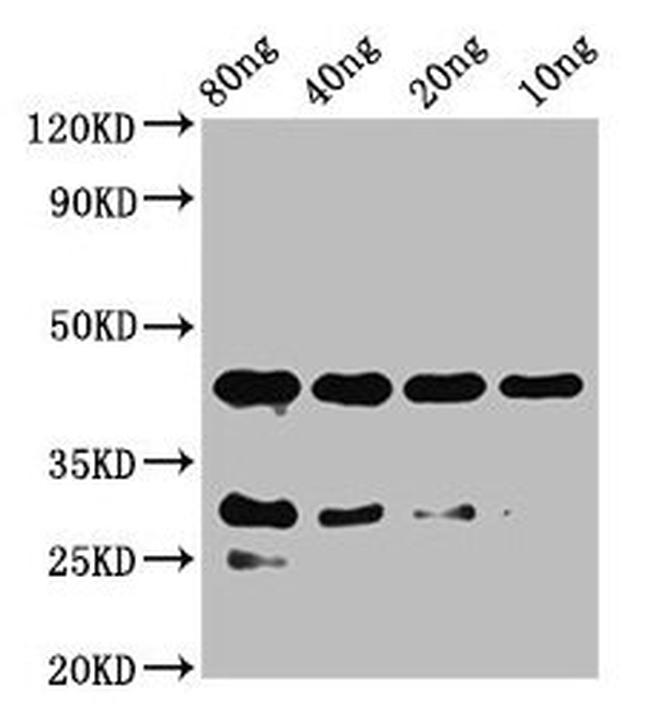 notchl Antibody in Western Blot (WB)