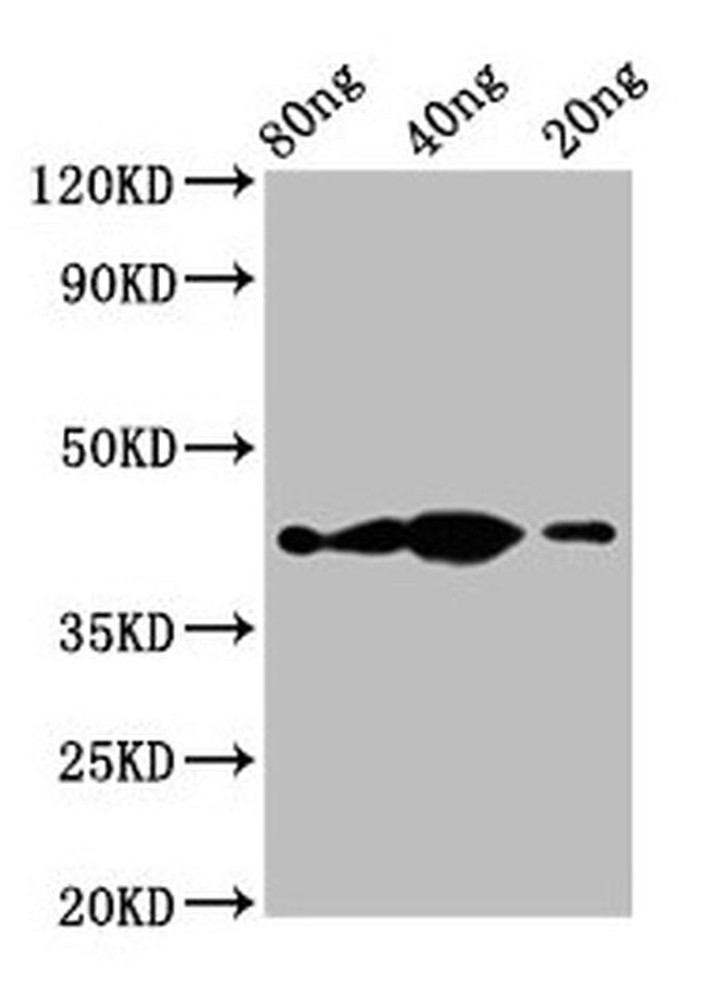 Tyrosine Hydroxylase Antibody in Western Blot (WB)